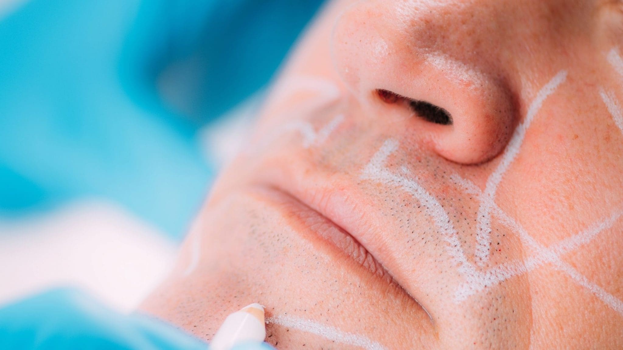 Read more about the article What are dermal fillers? Benefits And effects