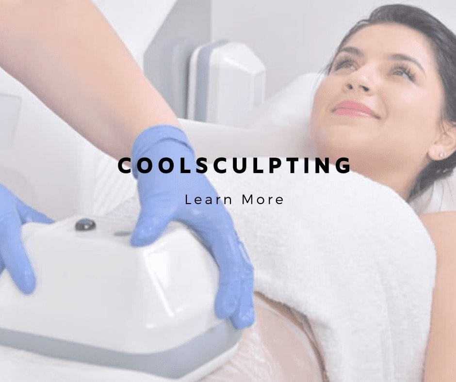 CoolSculpting Chicago