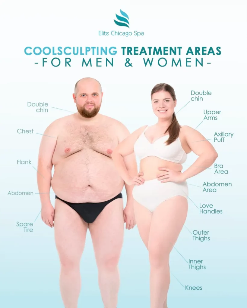 how-much-is-coolsculpting-its-worth-it-everything-about-scoolculpting