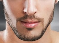 can men get facial laser hair removal?