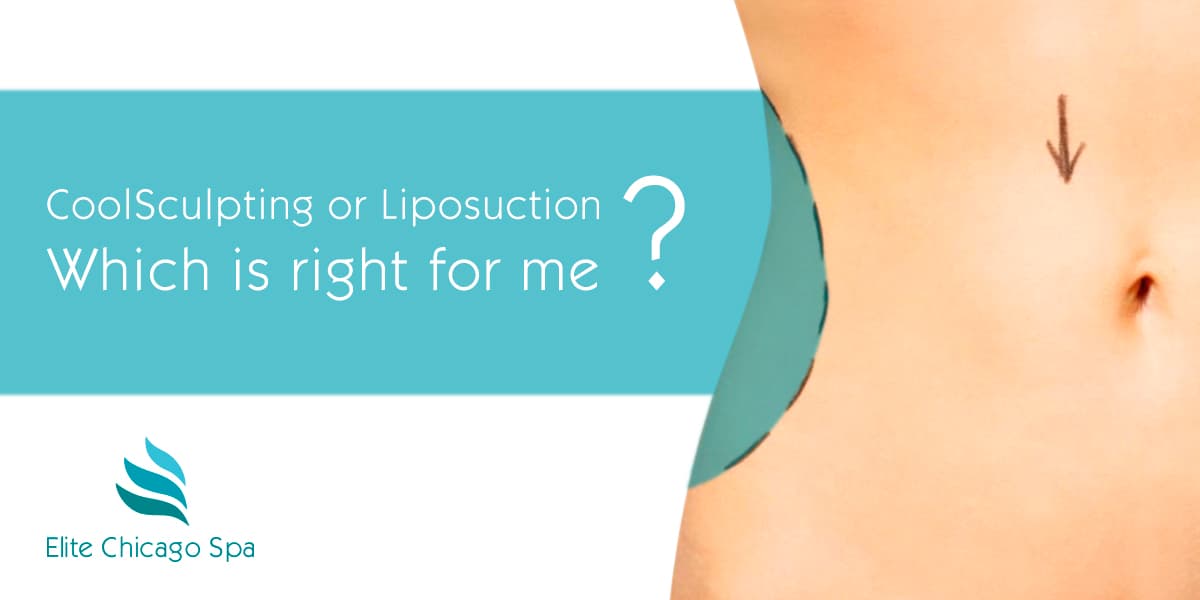 Read more about the article CoolSculpting Vs Liposuction: Which treatment works best?