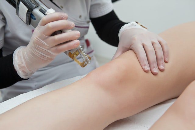 reasons to switch from waxing to laser hair removal