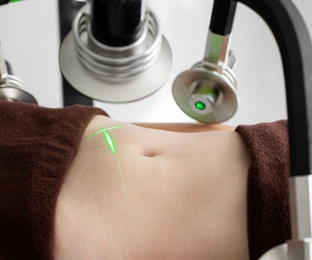 Non-Surgical Fat Reduction Chicago Illinois