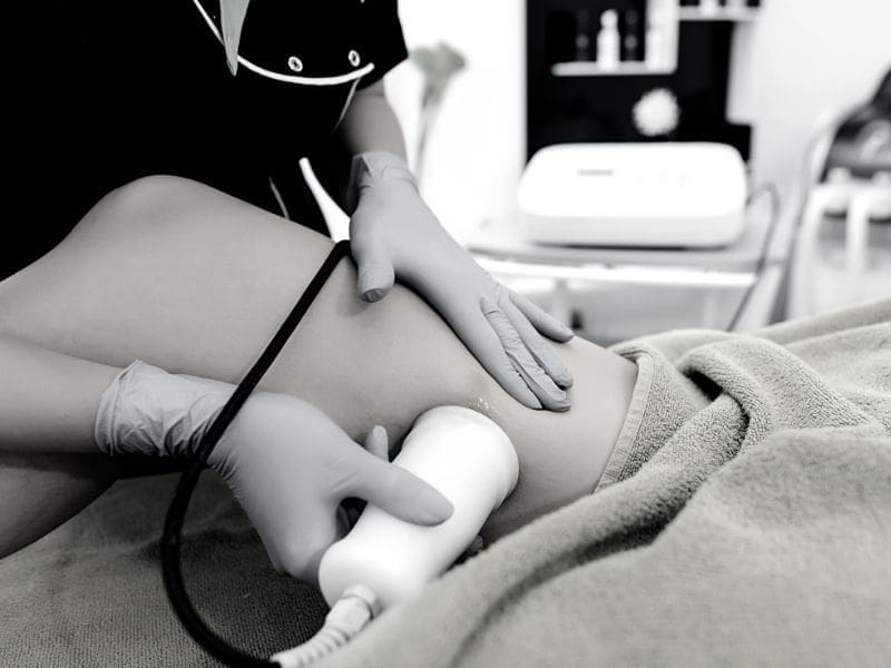 Cavitation Chicago Illinois