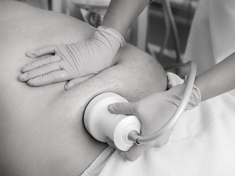 best fat reduction treatments