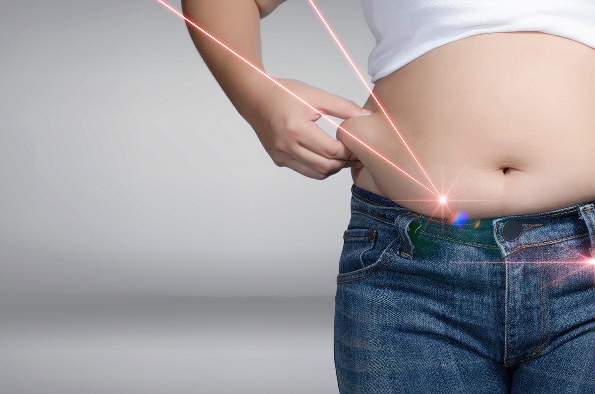 You are currently viewing What you Should Know Before Having Laser Liposuction
