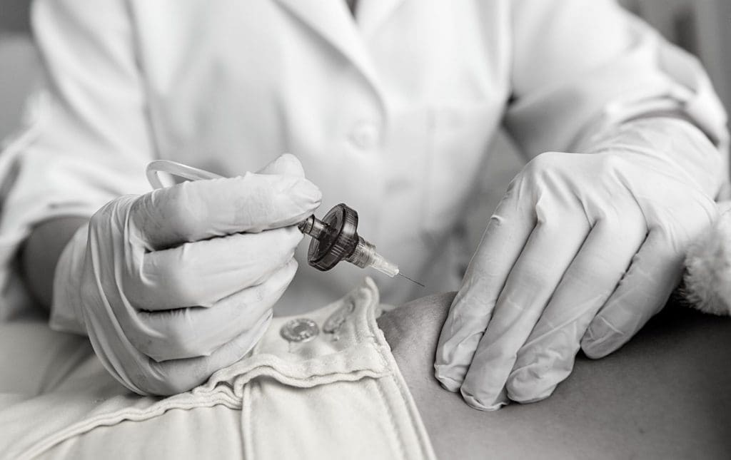 Carboxytherapy