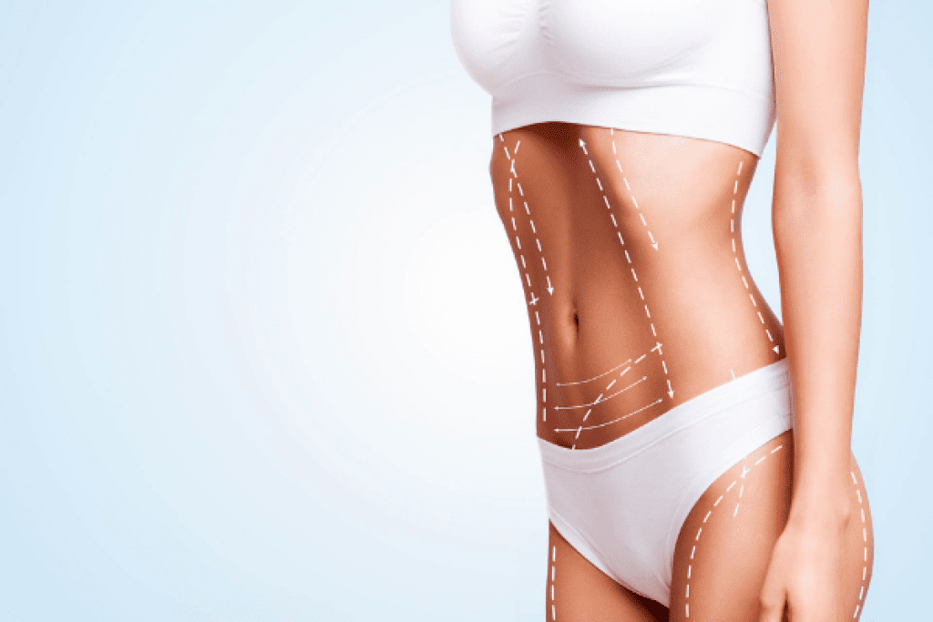 laser-fat-removal-treatment