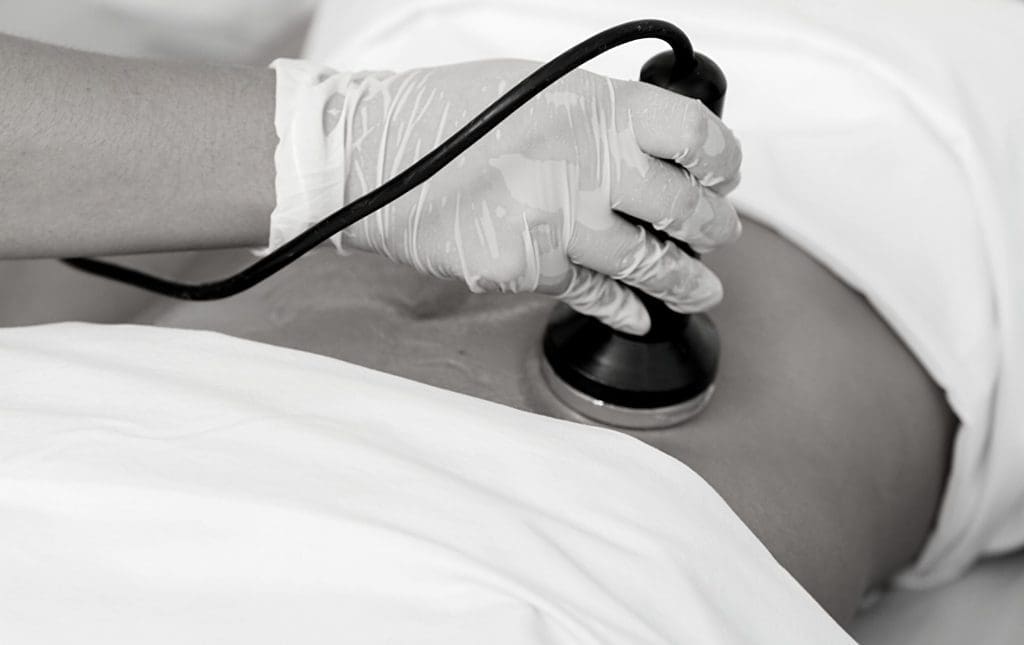 ultrasonic cavitation fat reduction