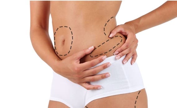 Reach your body goals at the gym with Coolsculpting