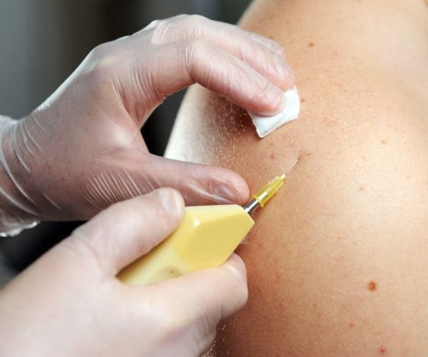 carboxytherapy in chicago