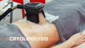 Read more about the article Coolsculpting Elite vs. Traditional Coolsculpting