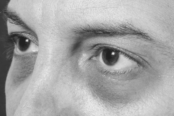 eye circles cleaning