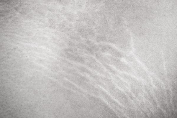 strecht marks