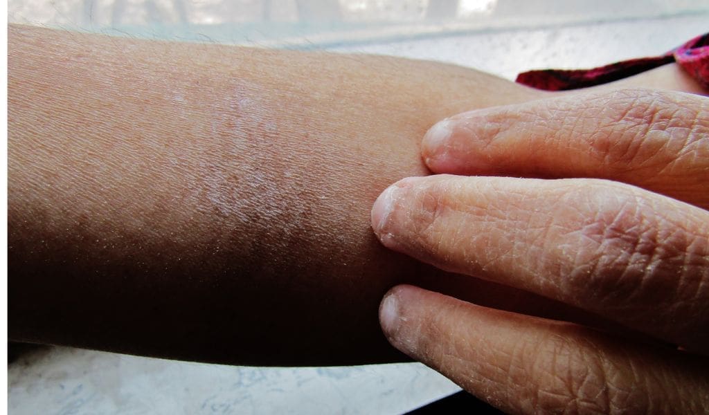 Read more about the article Skincare For Weather Changes: Tips For Health Care