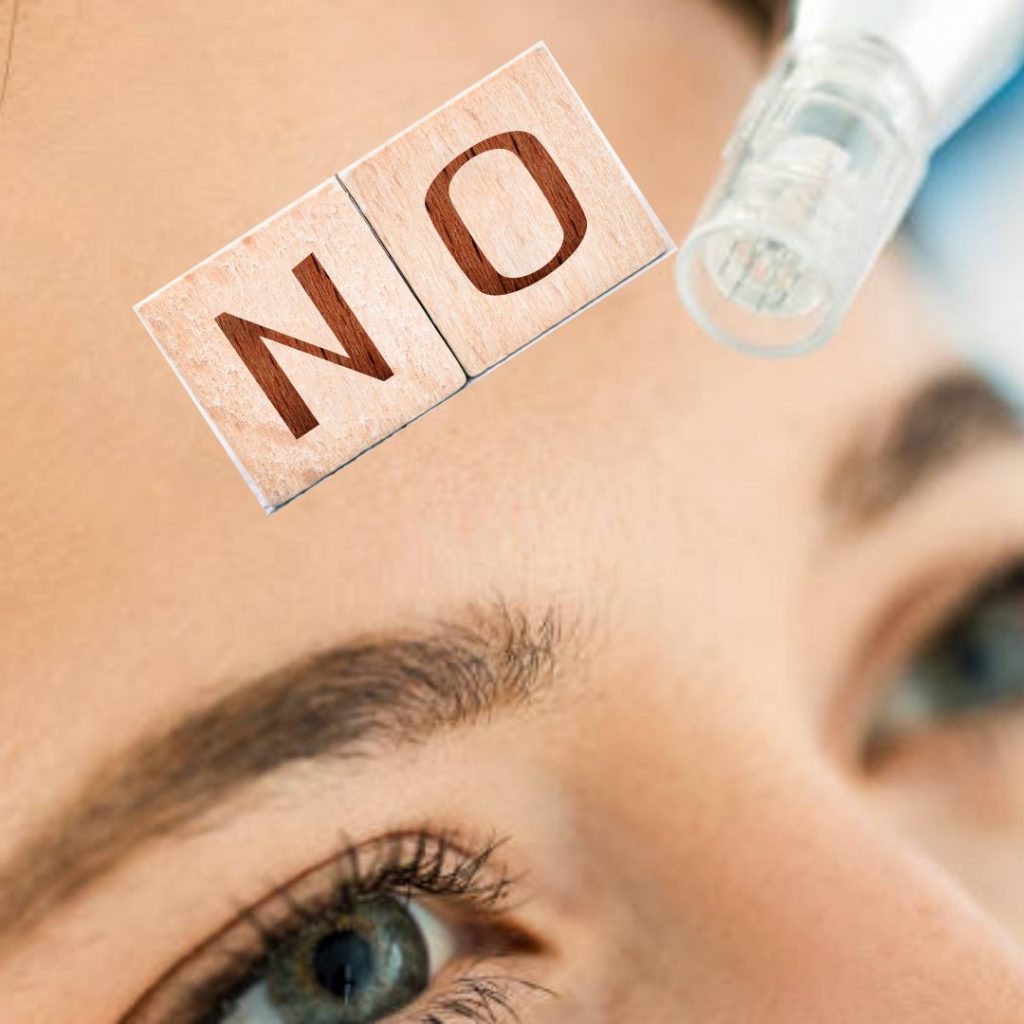 are-there-any-age-restrictions-for-undergoing-nano-needling-no-2