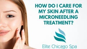 Read more about the article How Do I Care For My Skin After A Microneedling Treatment?