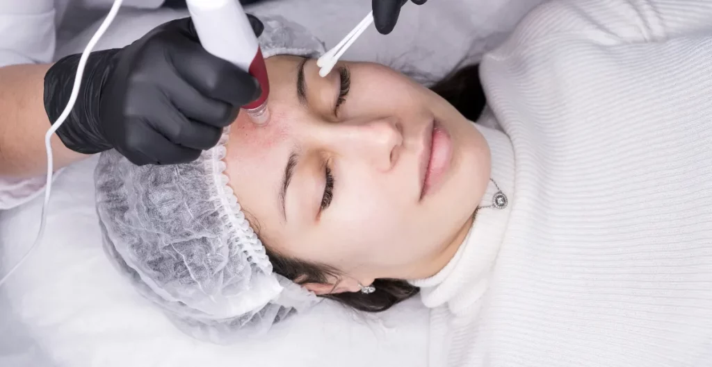 what-to-make-after-nano-needling