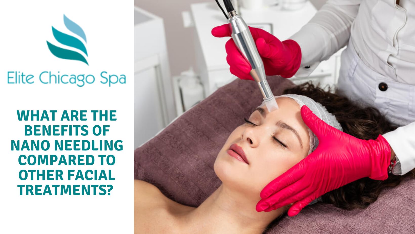 You are currently viewing What Are The Benefits Of Nano Needling Compared To Other Facial Treatments?