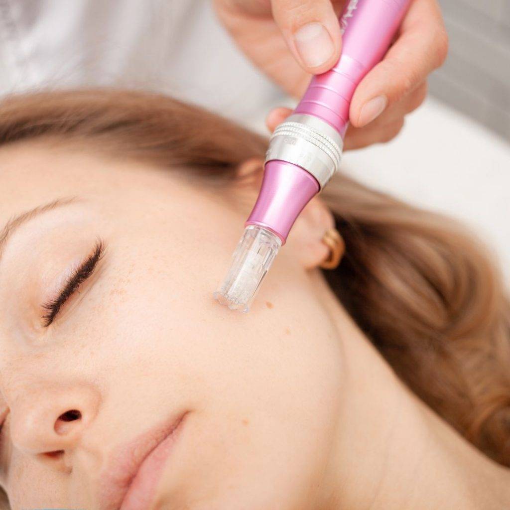 What Areas Of The Body Can Treat With Nano Needling - needling treatment