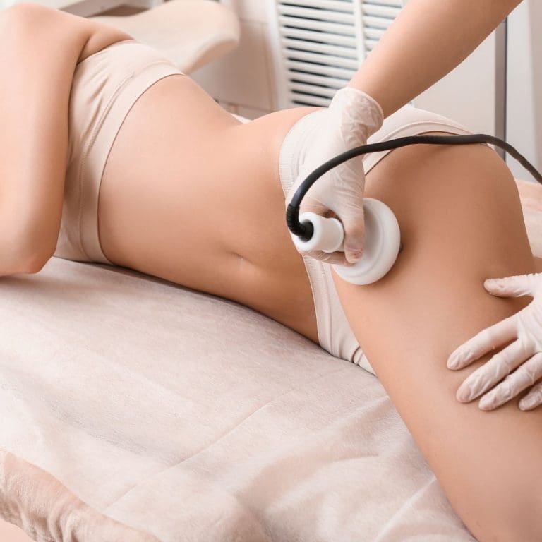 Chicago illinois cellulite removal