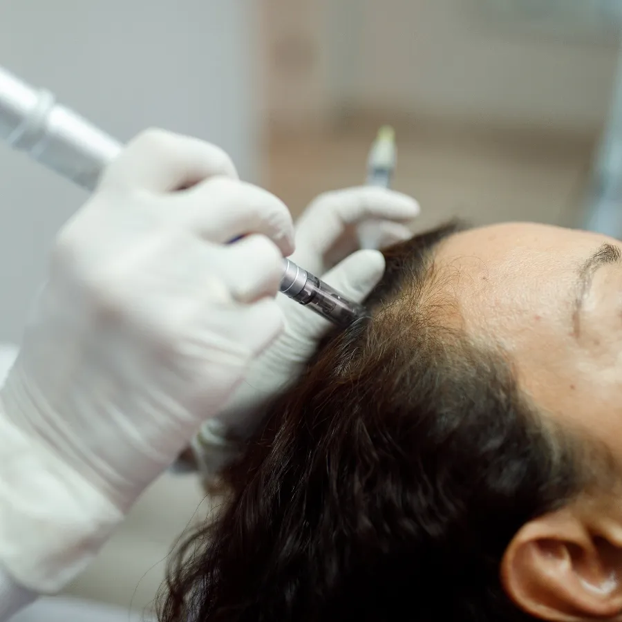 how-much-should-i-get-microneedling-treatmens-to-maintain-results