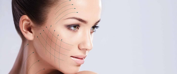 Read more about the article Thread Lift in Chicago: A less invasive face lift