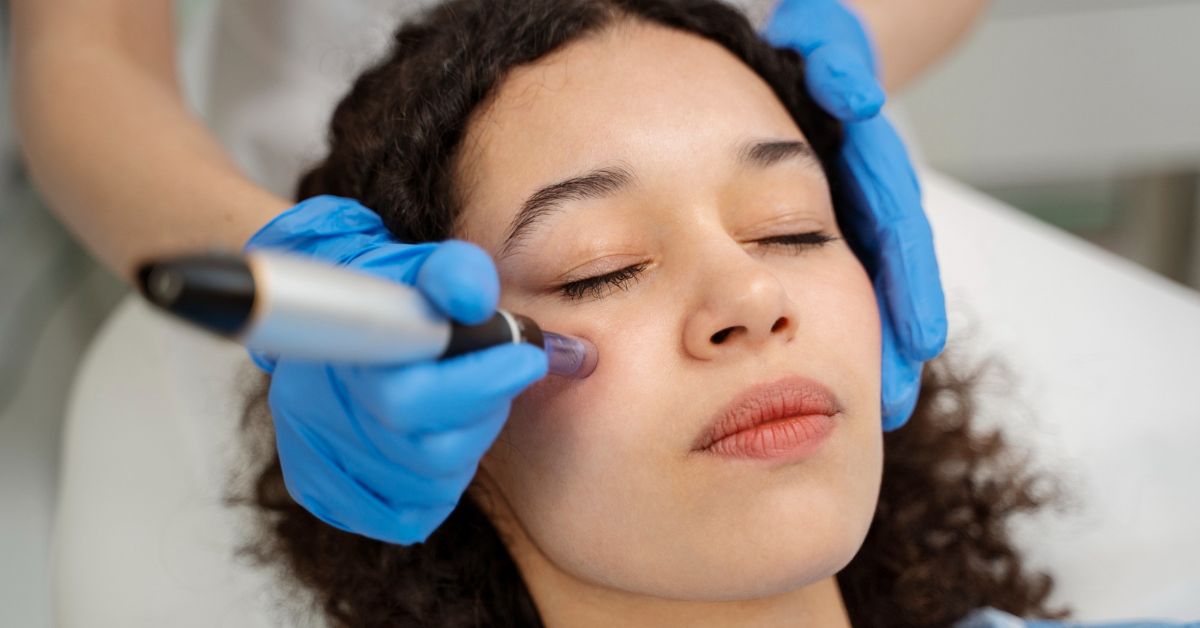 You are currently viewing Enhancing Skin with Micro-Needling
