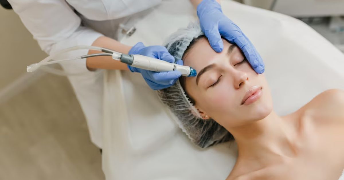 Read more about the article Painless Beautification: Micro-Needle Therapy!