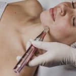 Revitalizing Skin with Dermarolling