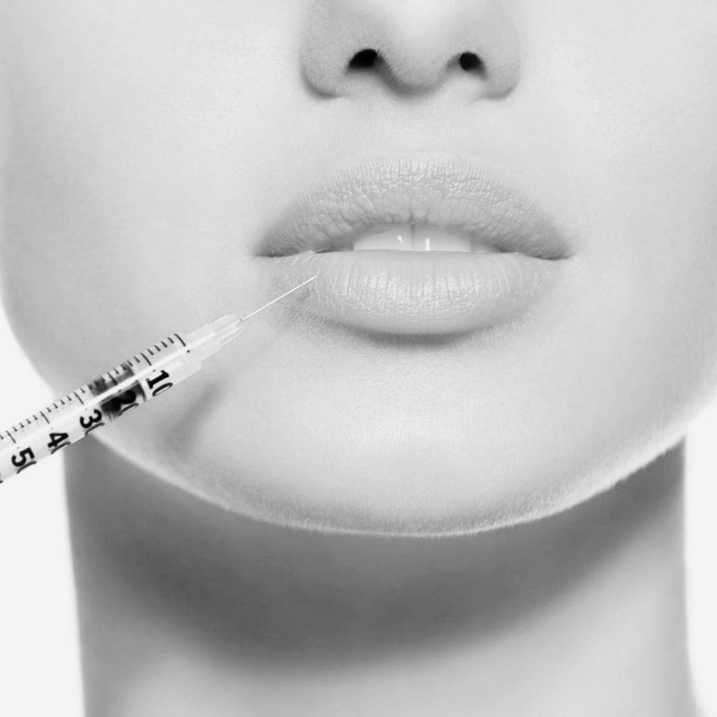 elite-chicago-spa-lip-injections-chicago