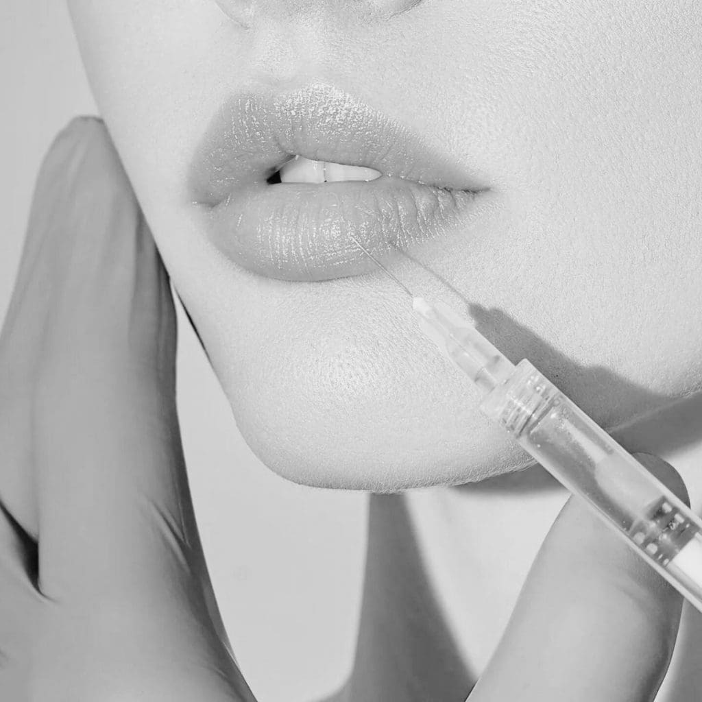 elite-chicago-spa-lip-injections-deals-in-chicago