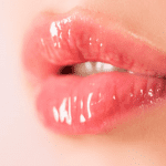 Lip Augmentation: Techniques