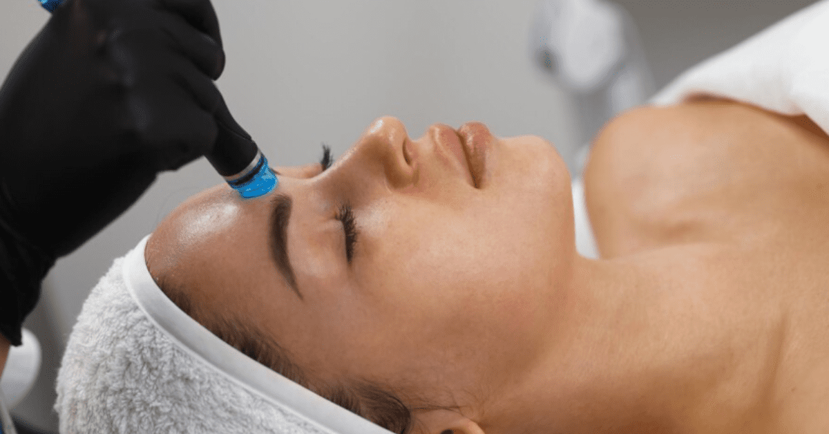 You are currently viewing Microdermabrasion in Addressing Hyperpigmentation
