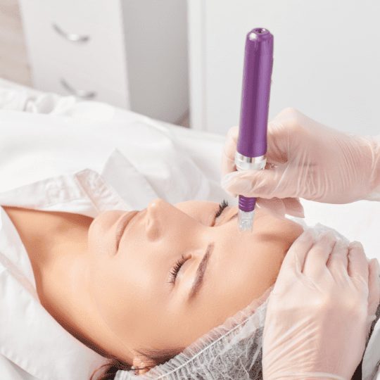 The Best Microneedling Andersonville IL