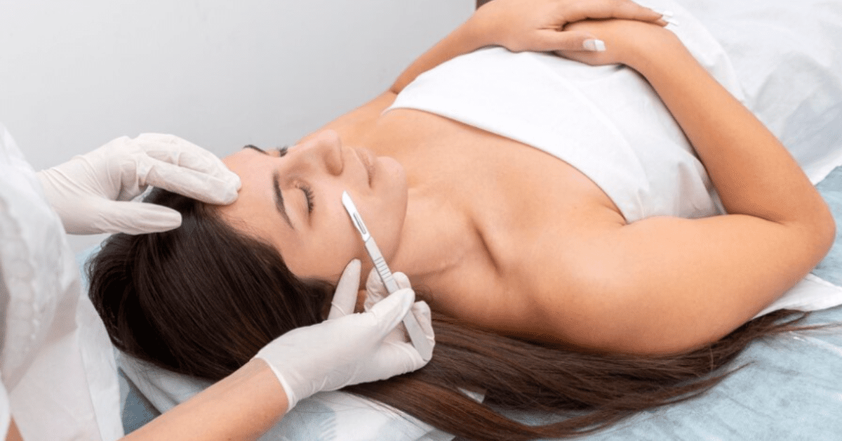 Read more about the article Chicago Skincare: Dermaplaning for Smooth, Radiant Skin