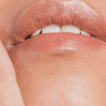 Essential Aftercare Tips for Lip Filler Procedures