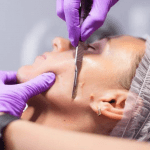 Experience Ultimate Skin Rejuvenation: Dermaplaning in Chicago