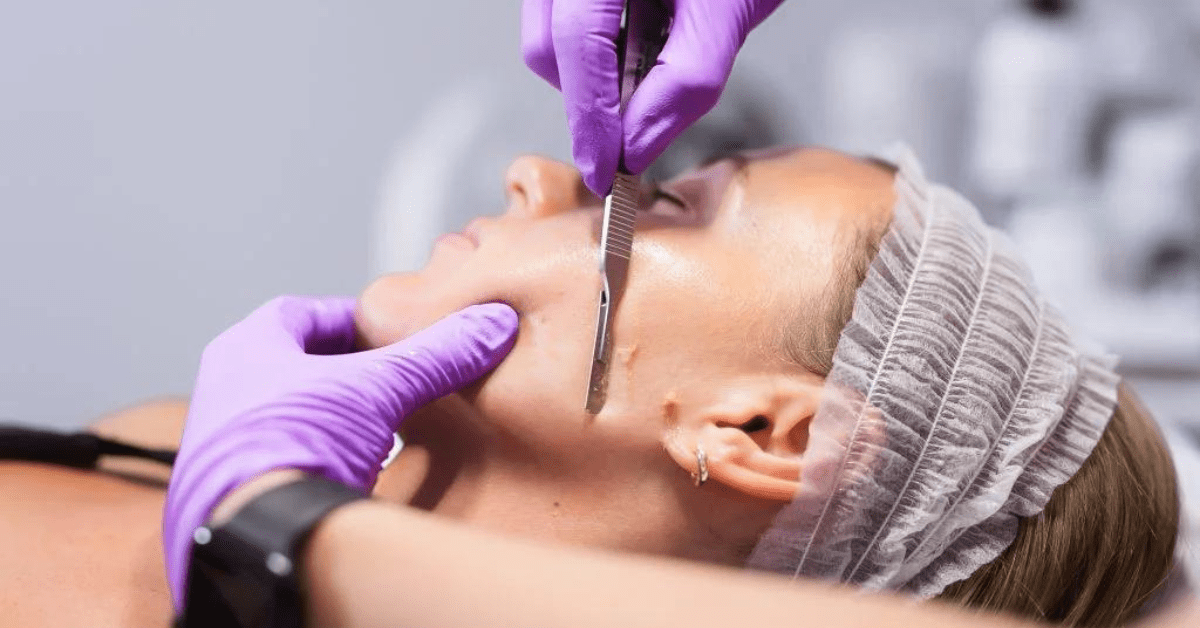 You are currently viewing Experience Ultimate Skin Rejuvenation: Dermaplaning in Chicago