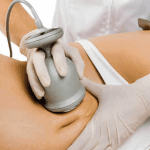 Ultrasonic Cavitation: Safety Measures and Potential Side Effects