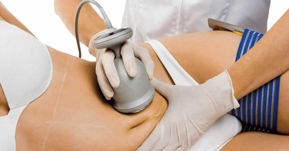 Read more about the article Ultrasonic Cavitation: Safety Measures and Potential Side Effects