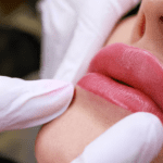 What You Need to Know About Lip Filler Recovery