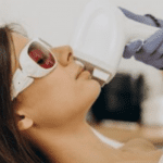 Longevity of Results: Laser Hair Removal Analysis