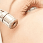 Microdermabrasion: A Must-Have for Your Spa Day