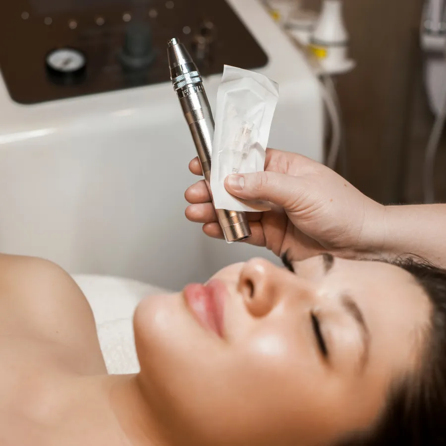 revitalize-hair-growth-microneedling-for-hair-loss
