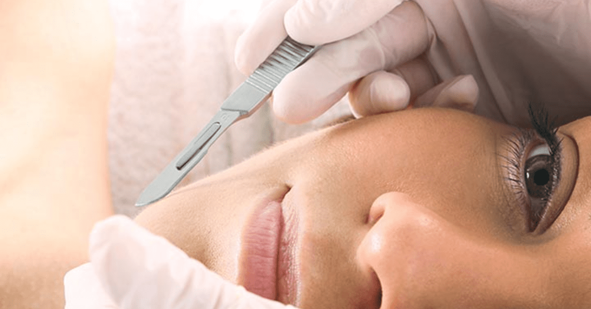 You are currently viewing Dermaplaning: A Solution for Various Skin Concerns