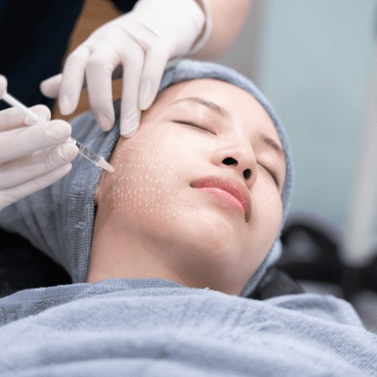 microneedling-lincoln-park-2
