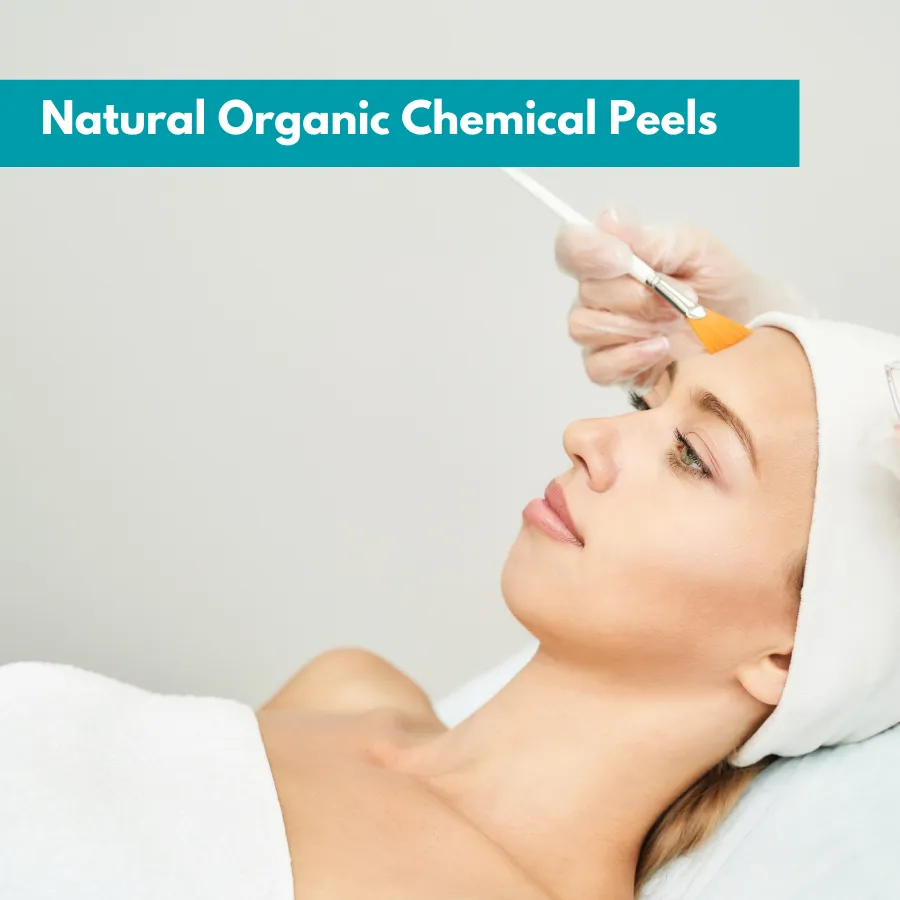 Organic Chemical Peels