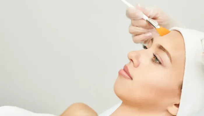 You are currently viewing The All-Natural Organic Chemical Peels Taking Chicago by Storm
