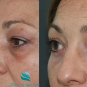 Anti-Aging Facial